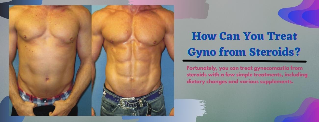 How Can You Treat Gyno from Steroids?